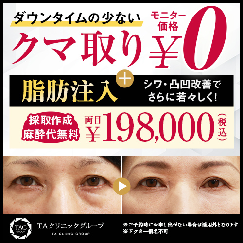 下眼瞼脱脂（目の下のクマ・ふくらみとり）＋脂肪注入モニター募集